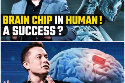 In 2025, Elon Musk Predicted That ‘Hundreds of Millions’ of People Will Have His Brain Chips Within the Next 20 Years, so Don’t Forget to Hold Him to It