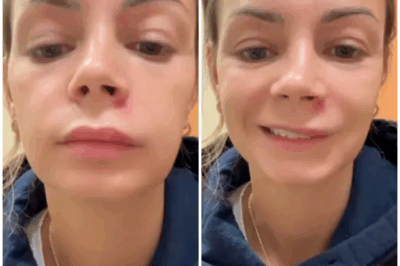 🚨 Pimple-Popping Disaster: Woman Ends Up in Urgent Care After Squeezing Zit in ‘Triangle of Death’! 😱