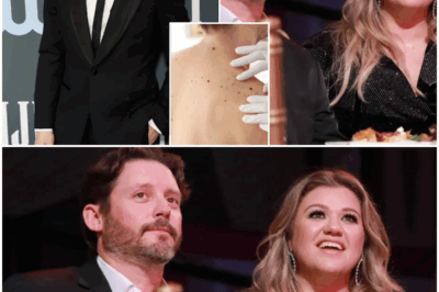 What to know about dangerous ‘black tumor’ cancer as Kelly Clarkson’s ex-husband Brandon Blackstock dies at 48